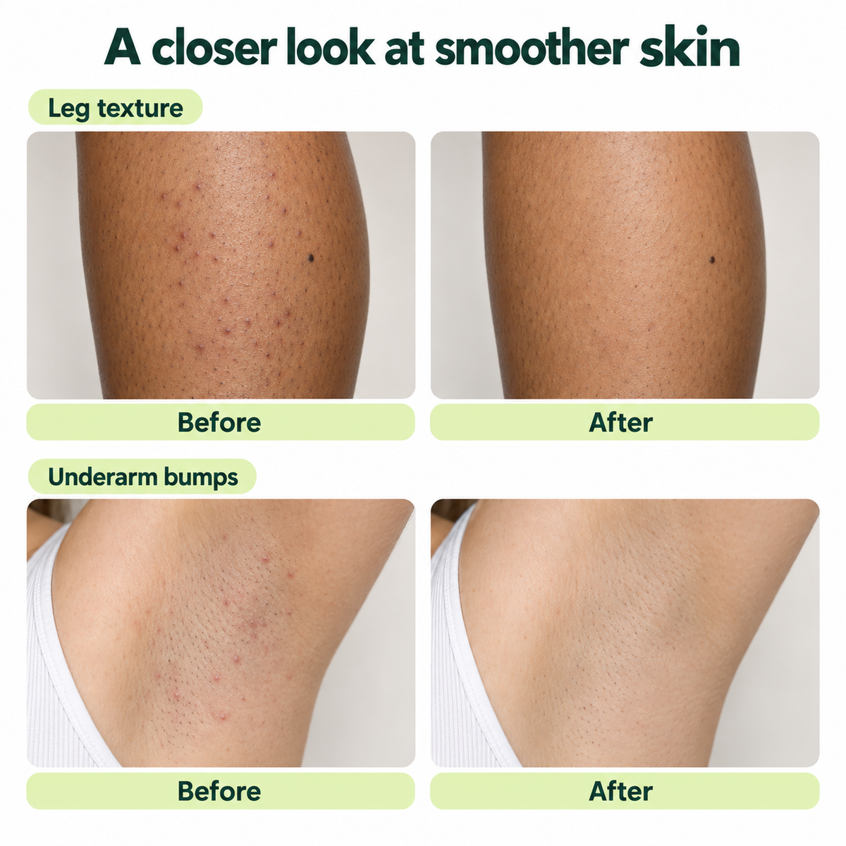 Smoothing Solution — Ingrown Hair Roll-On
